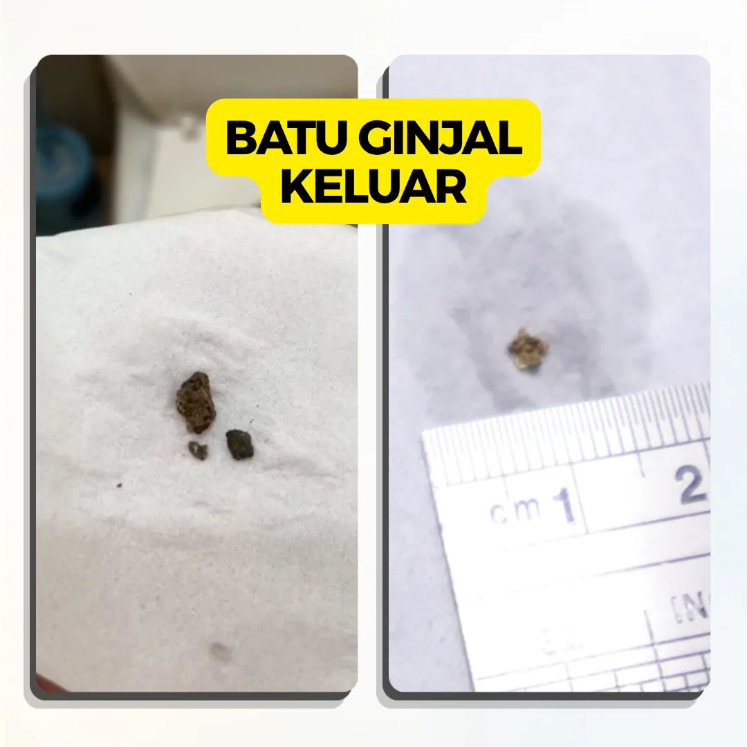 Testimoni Gambar - TESTIMONI 1