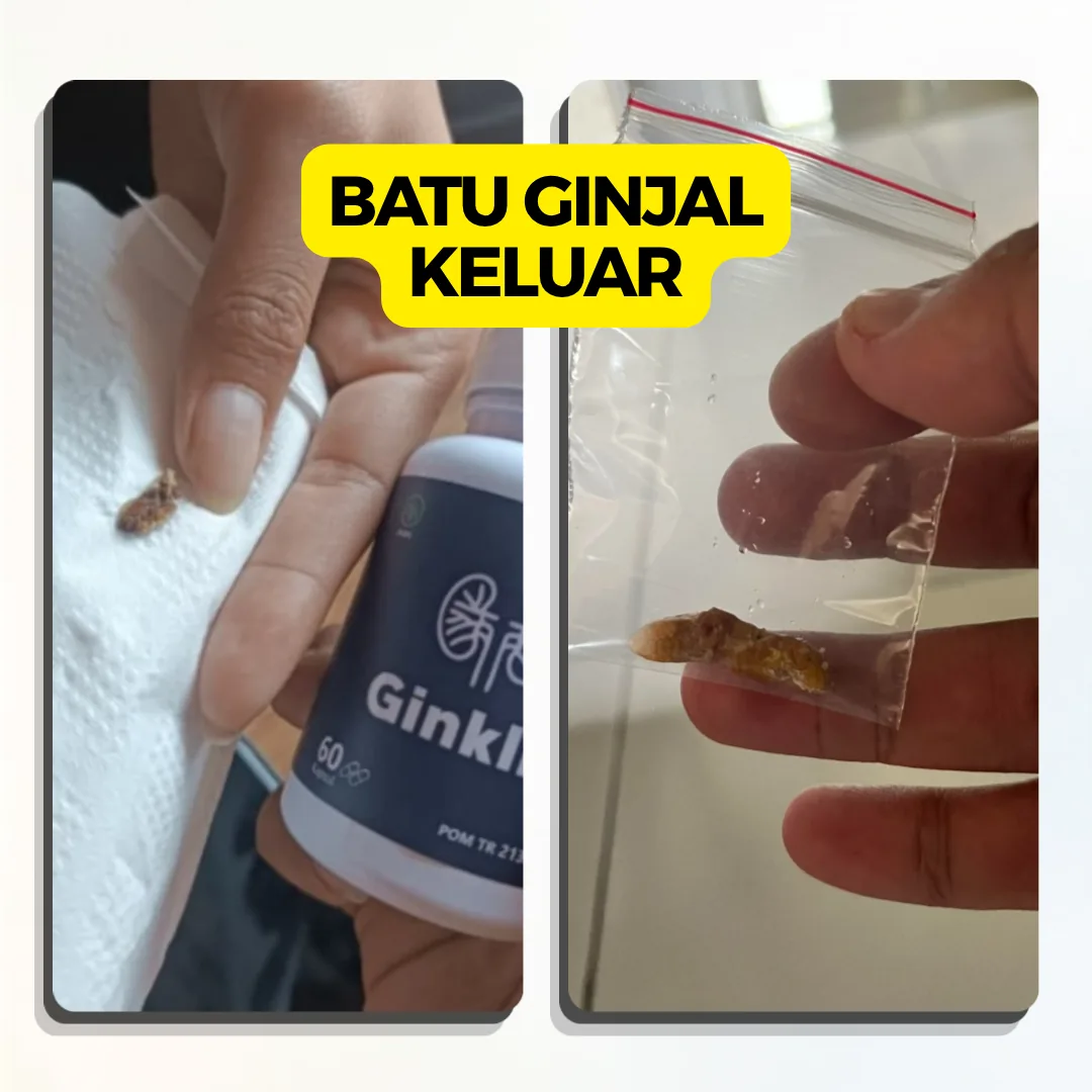 Testimoni Gambar - TESTIMONI 2